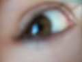 oeil
